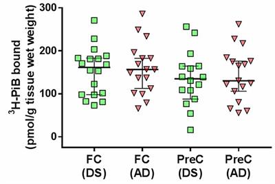 Postmortem Neocortical 3H-PiB Binding and Levels of Unmodified and Pyroglutamate Aβ in Down Syndrome and Sporadic Alzheimer’s Disease